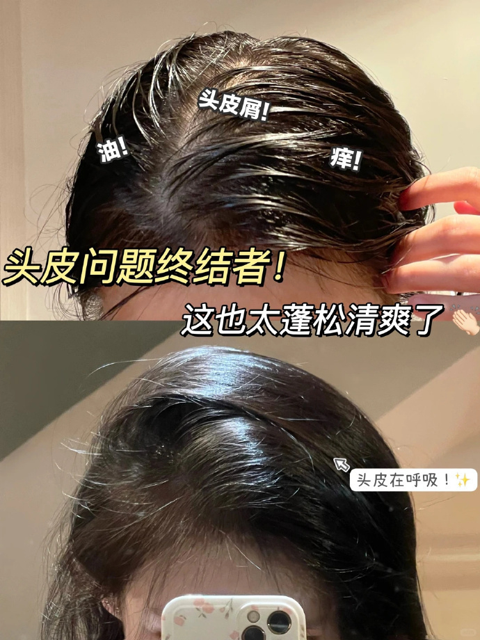 科丽尼头皮素48ml 21.9元 - 折送网
