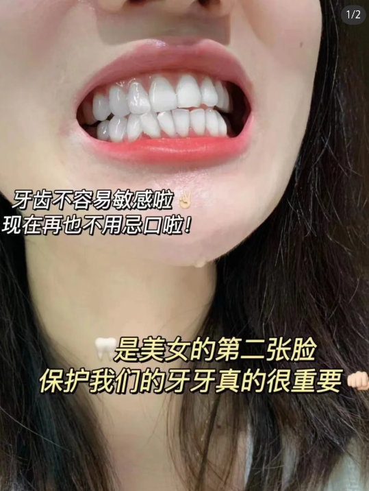 冷酸灵清火护龈抑菌牙膏5大支+2小支 13元 - 86线报
