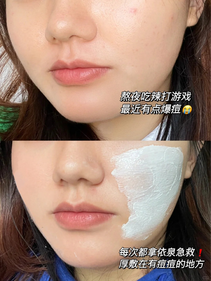 依泉B5绷带霜40ml 50元 - 86线报 依泉B5绷带霜40ml 50元 - 86线报