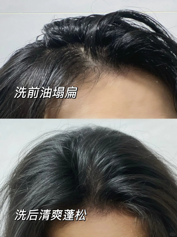 药厂亲自下场做洗发水 主打对症下药 生姜+普洱精粹养护头皮 无硅油配方不伤发质 - 折送网