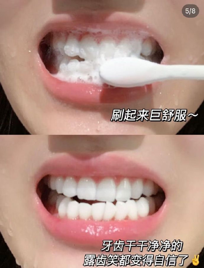 百元内性价比最 高的电动牙刷❗️ 69💰舒客 T2电动牙刷礼盒 - 86线报