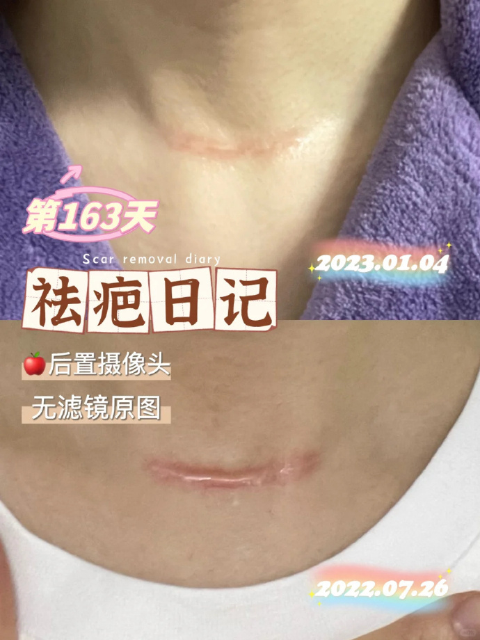 疤克6g 99元 - 86线报 疤克6g 99元 - 86线报