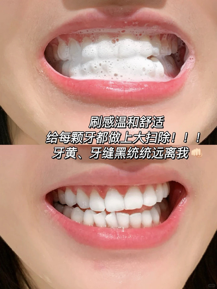 参半牙膏/牙刷/牙线 4.1元/支 - 86线报