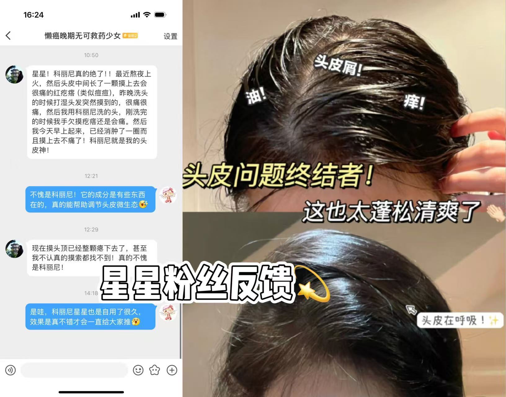 科丽尼头皮素 54元 - 线报酷 科丽尼头皮素 54元 - 线报酷