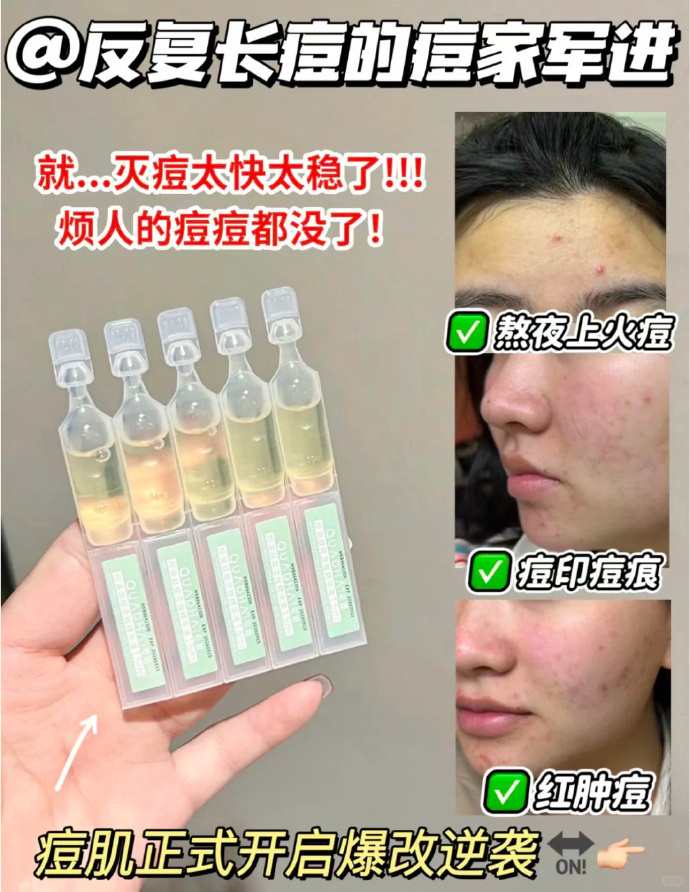 夸迪战痘次抛30支 50.9元 - 线报酷