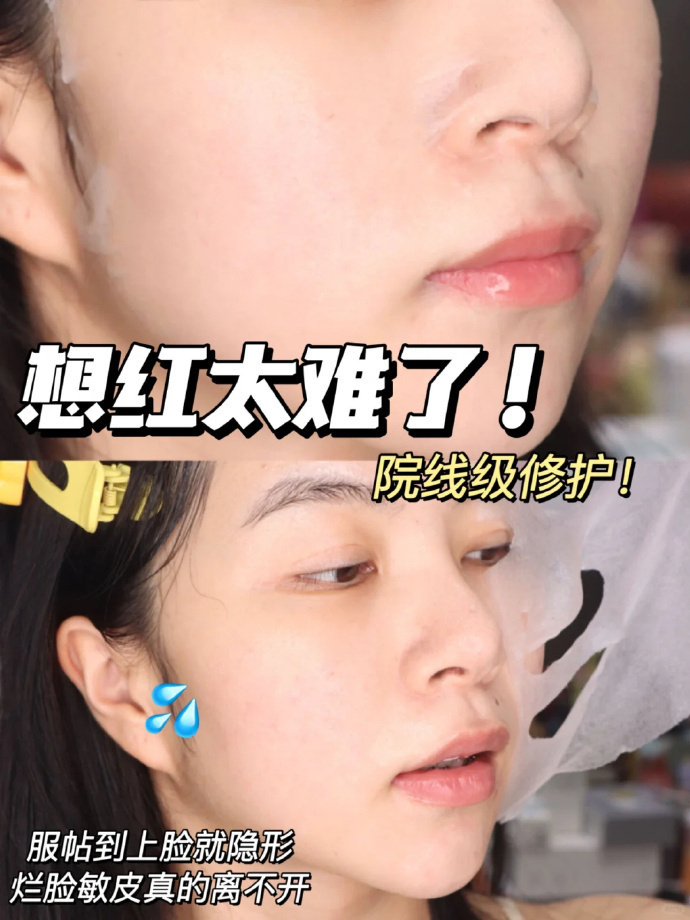 绽妍胶原蛋白敷料17片 59元 - 86线报