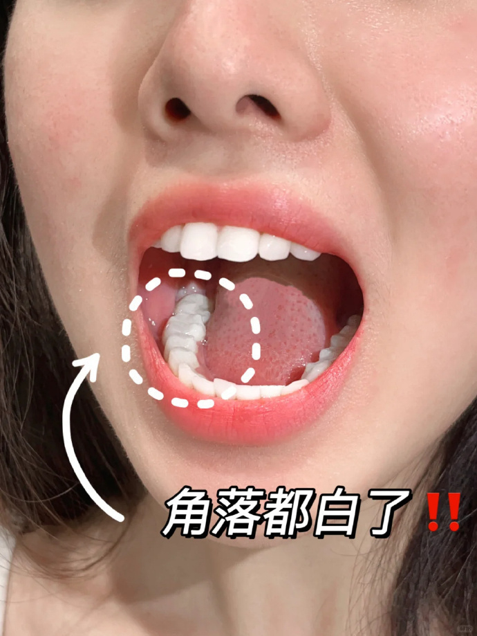 冷酸灵酵素米白牙膏 8元 - 86线报