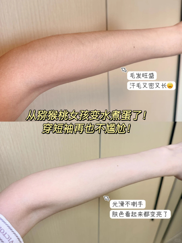 ulike air20脱毛仪 1437-1477元 - 86线报