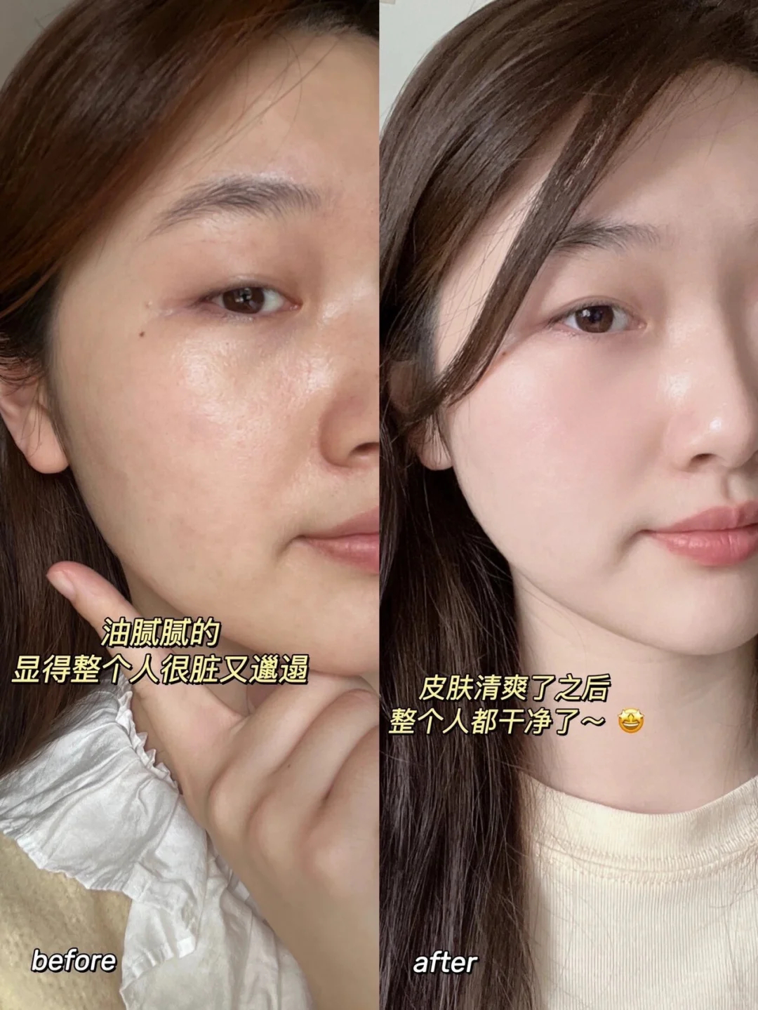 BM肌活糙米水乳2.0水100ml+乳100ml+同款精华水30ml 76.9元 - 线报酷