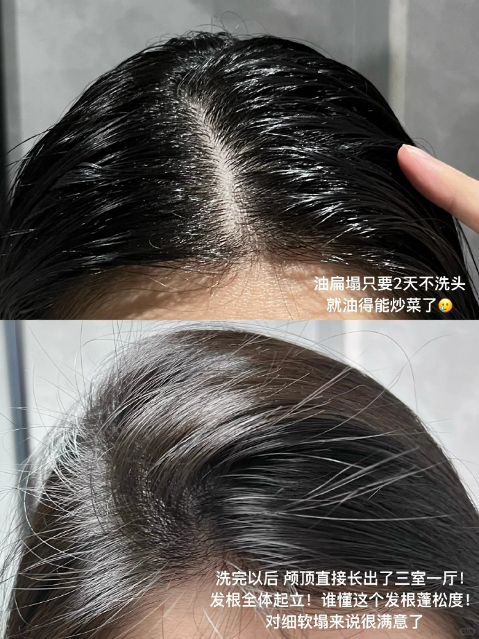 科丽尼头皮素75ml+赠36ml控油头皮素 75元 - 线报酷