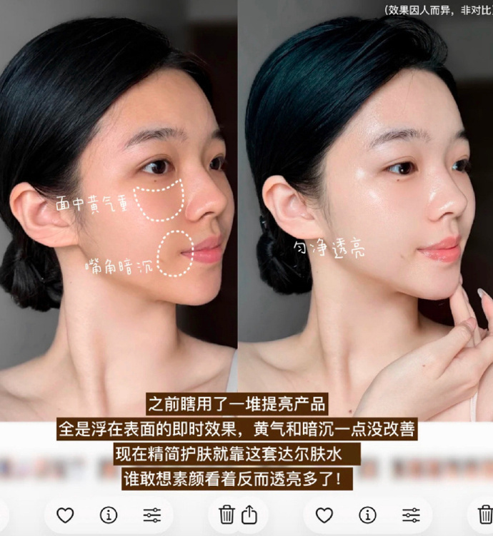达尔肤杏仁酸抛光水100ml*5 29元 - 86线报