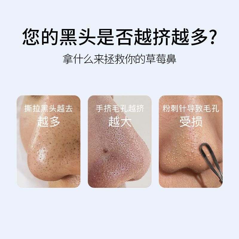 敷益清黑头鼻贴2盒 24元 - 线报酷