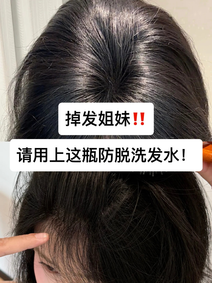 卡蓓诺防脱洗发水355ml 29.9元 - 86线报