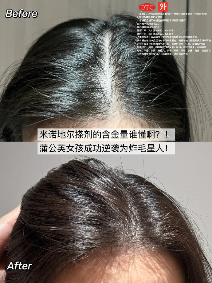 达霏欣米诺地尔酊搽剂60ml+上药滚珠瓶 78元 - 清风线报