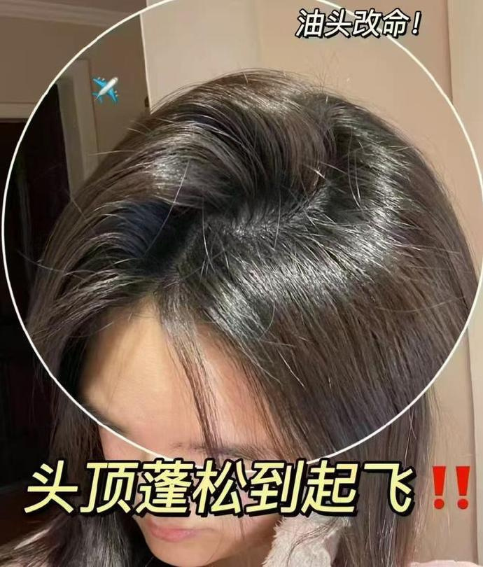 舒蕾氧活洗发水400g*3瓶 拍3件 39元 - 线报酷