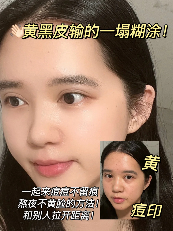 妮维雅630能亮瓶精华30ml+赠双能白面膜3片 139元 - 折送网
