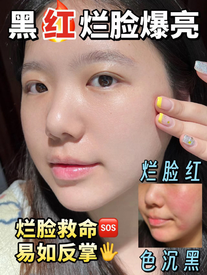 薇诺娜透明质酸保湿精华液30ml 44元 - 86线报