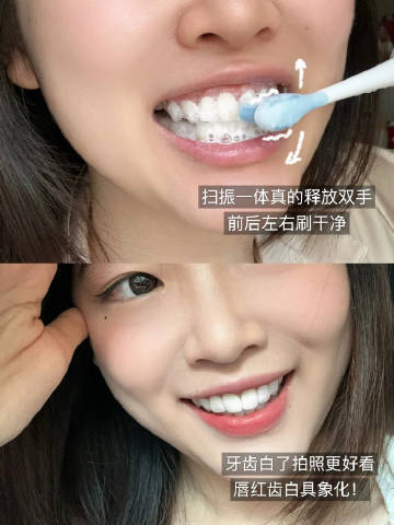 福派电动牙刷+5个刷头+充电线 35元 - 86线报
