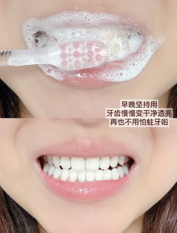 冷酸灵抗敏牙膏极地白×2+极地爽×1 37.9元 - 86线报
