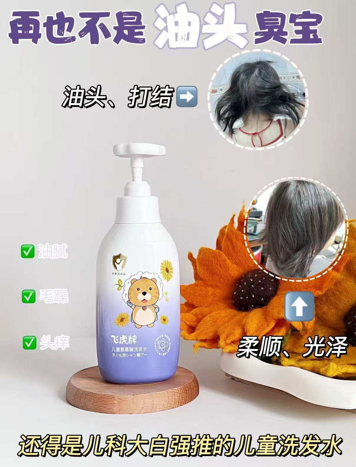 飞虎牌儿童氨基酸洗发水300g×2瓶 49.4元 - 美泡泡
