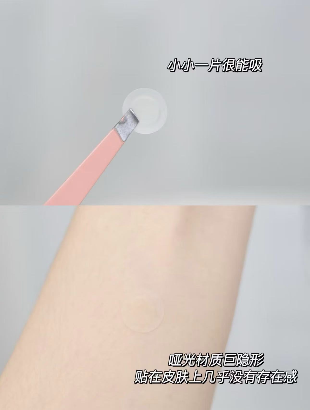 维德医疗创可贴拍2件共200片 12.8元，维德医疗痘痘贴48贴/袋 12.8元 - 86线报