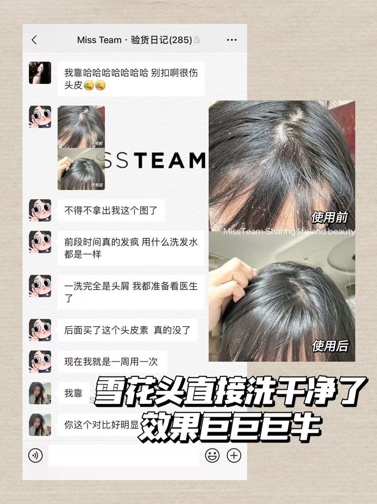 所有头屑头痒头皮痘都来用 15.9🉐30ml科丽尼头皮素 - 线报酷 所有头屑头痒头皮痘都来用 15.9🉐30ml科丽尼头皮素 - 线报酷