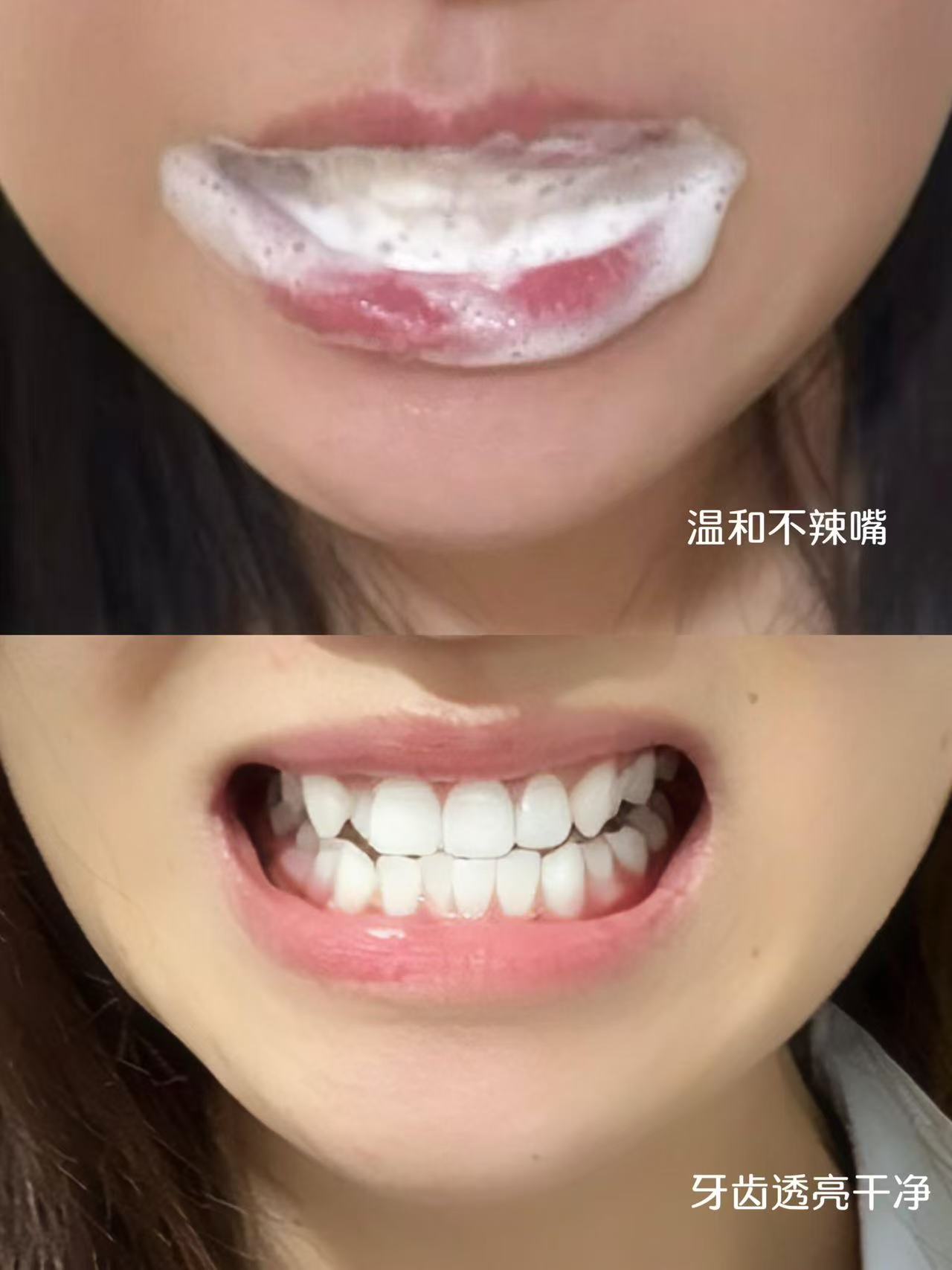 冰伊莱牙膏组合任选4件 19元 - 86线报