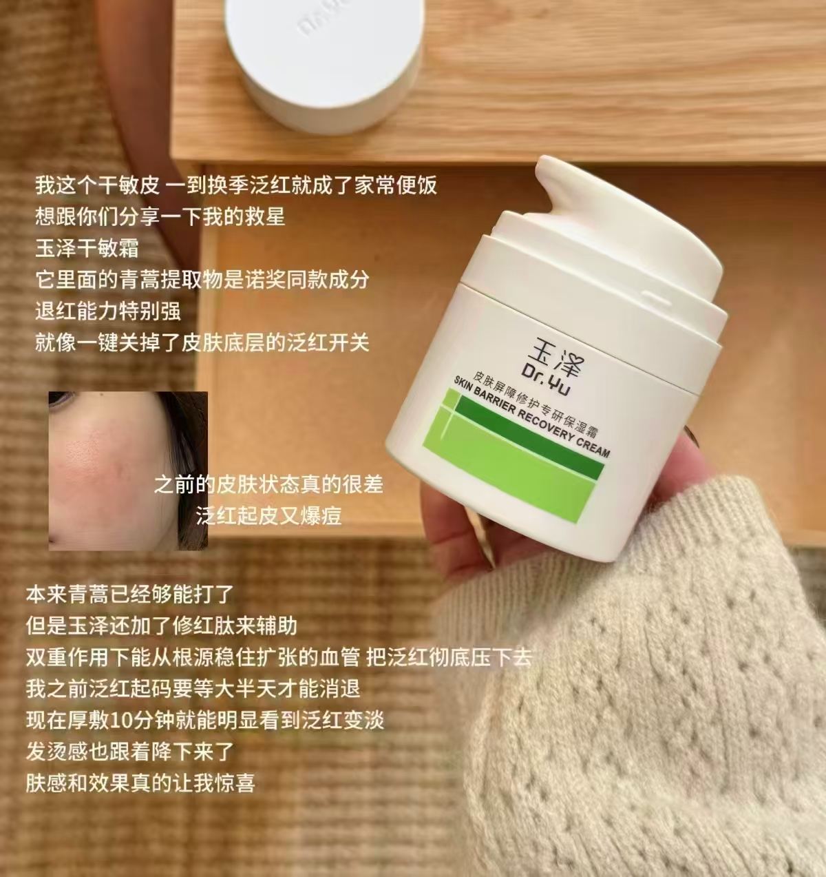 玉泽屏障修护专研保湿面霜替换装50g✘2瓶 73元 - 86线报