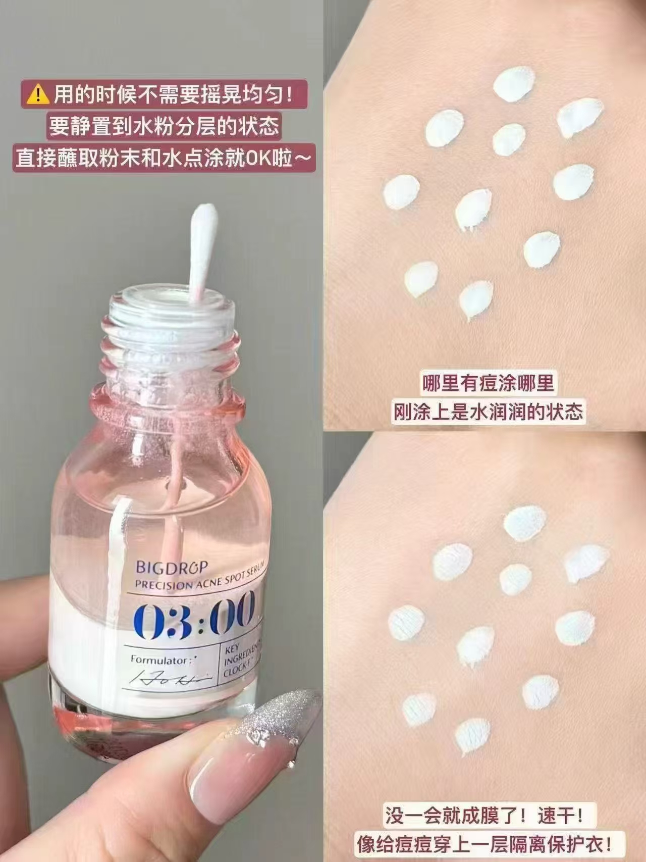 大水滴祛痘淡印精华2.0 7ml+3ml共10ml 送棉签*1 35.9元 - 线报酷