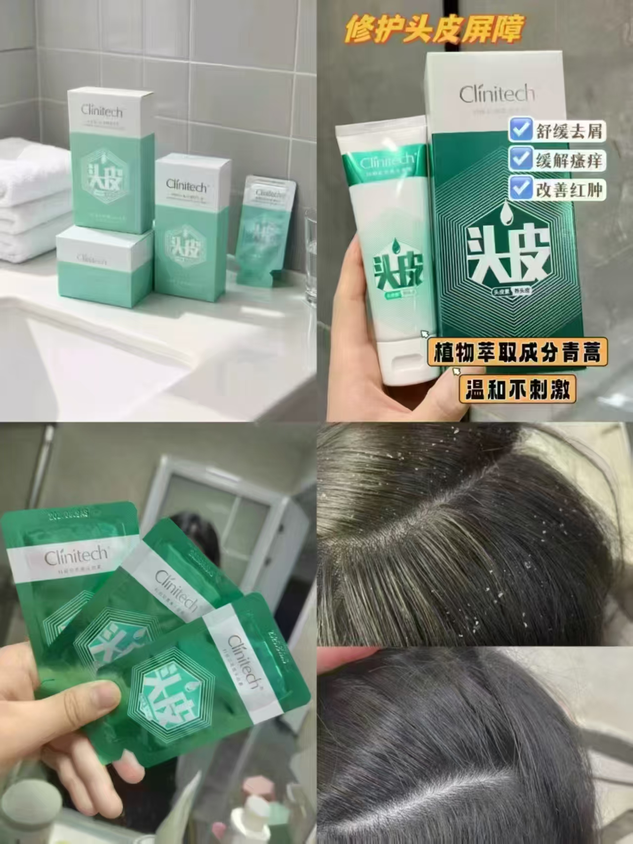 科丽尼控油去屑头皮素30ml 13.1元，科丽尼头皮素 13元 - 86线报