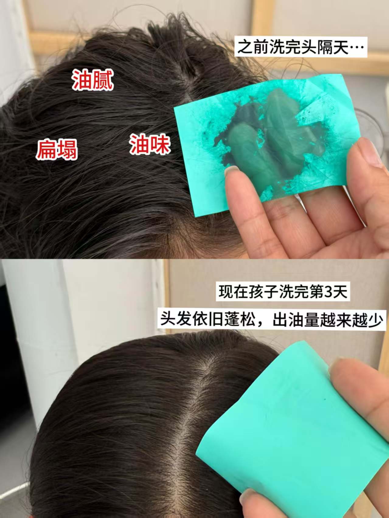 贝德美青少年洗发水335ml加赠同款20ml 39元 - 86线报 贝德美青少年洗发水335ml加赠同款20ml 39元 - 86线报