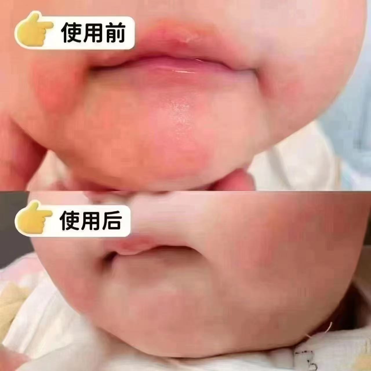 Akasugu新生婴幼儿屏障口水膏20g+15g 拍1发2支 共附42元 - 86线报