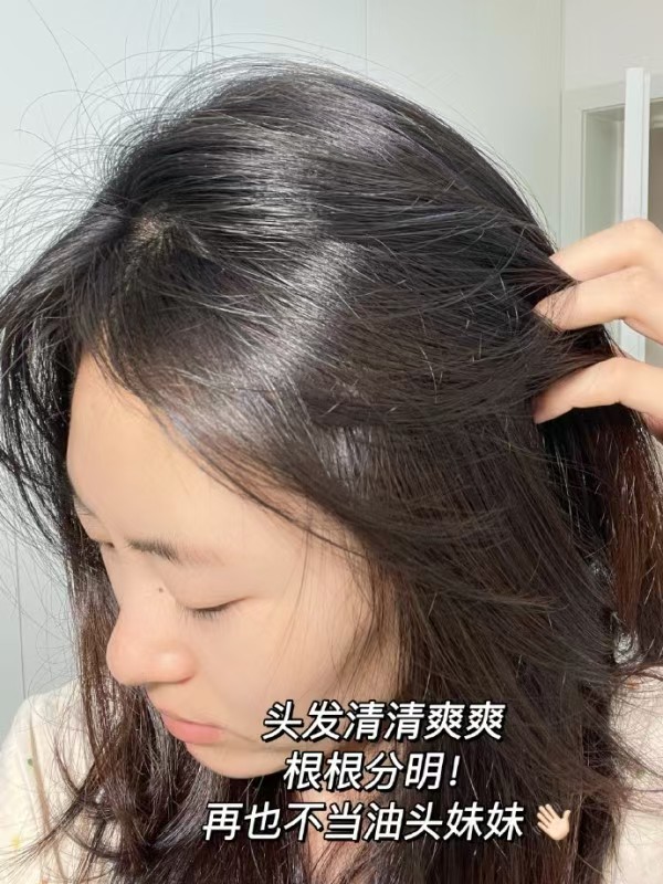赛逸二硫化硒专研去屑洗发水200ml×2瓶 66.8元 - 86线报