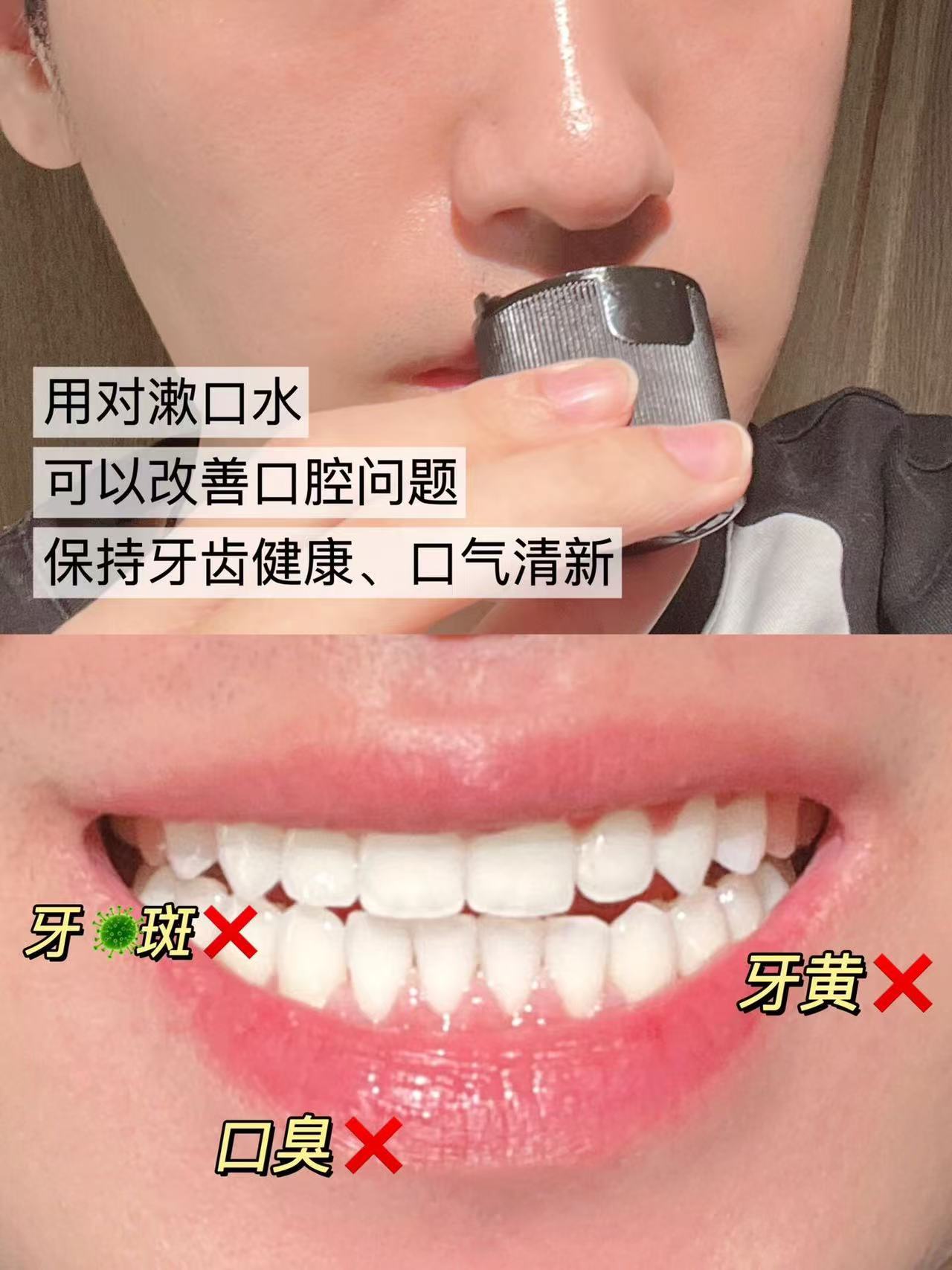 李施德林冰蓝零度精油漱口水 14元 - 86线报