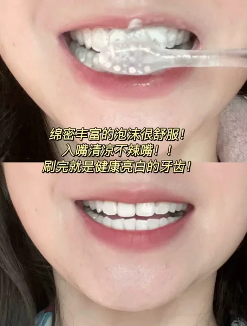 【淘享百补】高露洁竹炭健齿防蛀家庭装D 图片 2