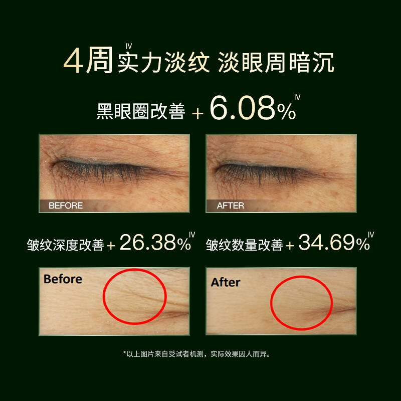 佰草集淡化细纹紧致眼袋女士眼霜15g 46元 - 86线报 佰草集淡化细纹紧致眼袋女士眼霜15g 46元 - 86线报