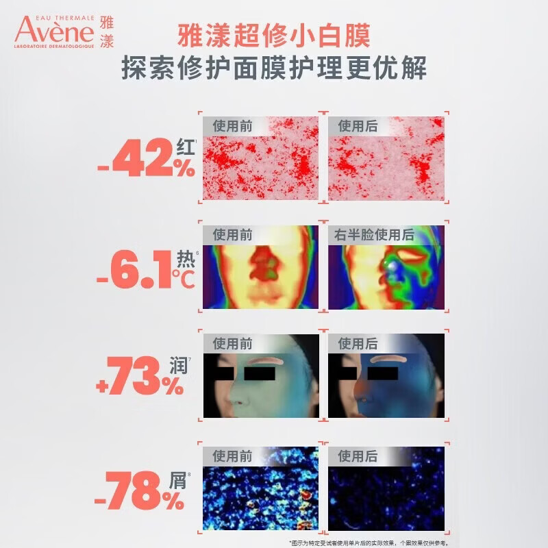 雅漾专研密集修护面膜10片 赠同款7片+祛痘舒缓面膜2片 93.17元 - 86线报