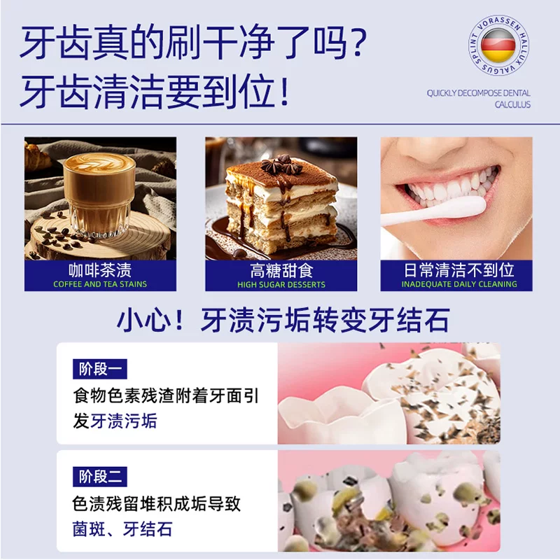 沃朗森医用非牙膏去牙结石溶解牙石速效去口臭除异味口气清新 26.6元 - 86线报