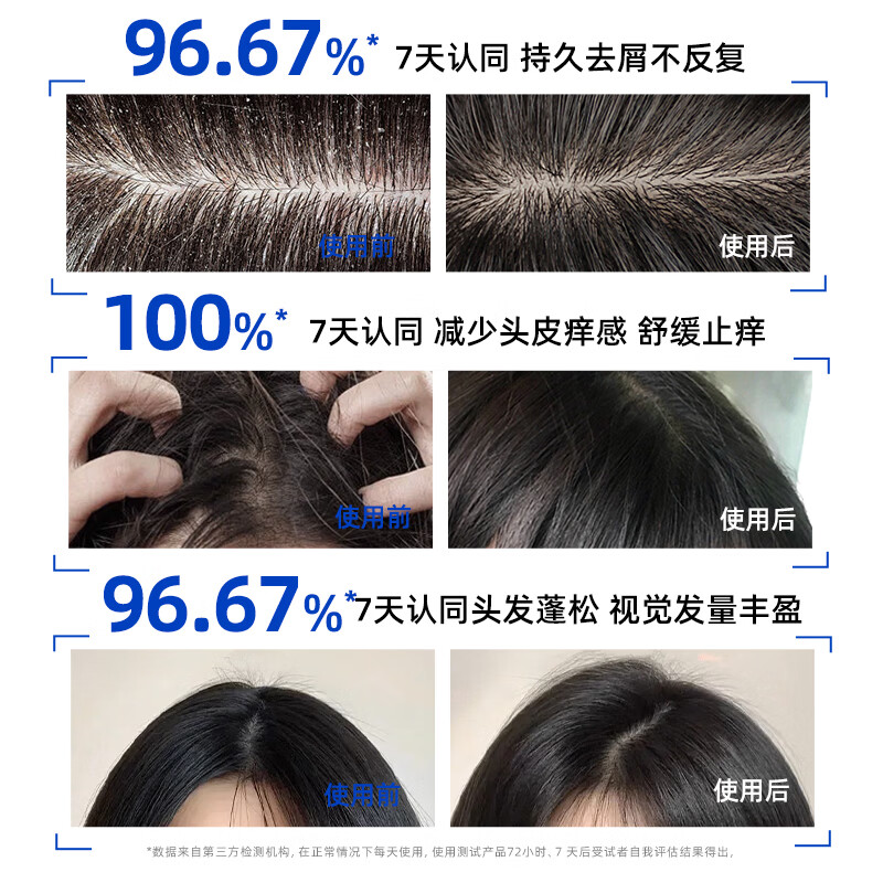 采乐二硫化硒洗发水300ml 14.9元 - 86线报