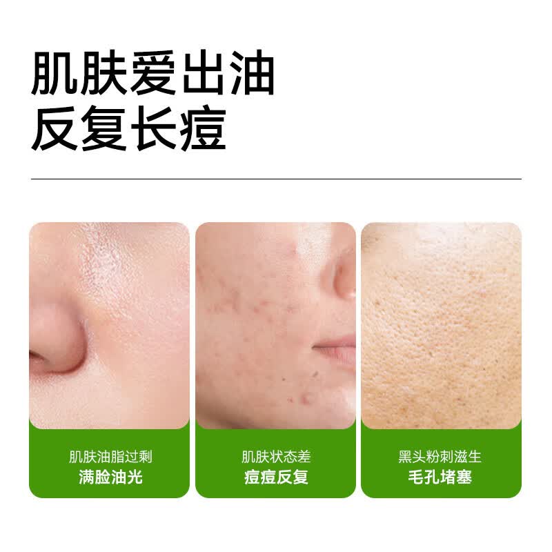满婷控油祛痘清螨皂100g 2.8元 - 86线报