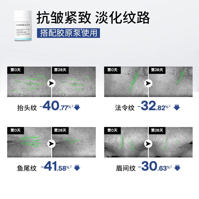Ulike童颜超光炮美容仪水光仪脸部嫩肤仪光子嫩肤保湿紧致抗皱 2791元 - 线报酷