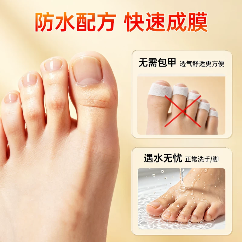时景盐酸阿莫罗芬搽剂正品灰指甲专用药 39.01元 - 清风线报