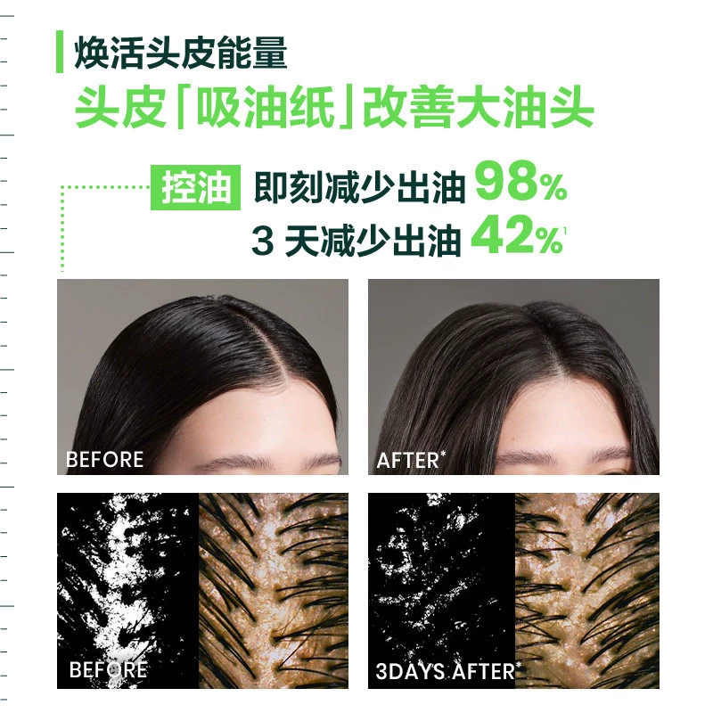 馥绿德雅洗发露控油蓬松丰盈发量感减少断落发 81元 - 线报酷