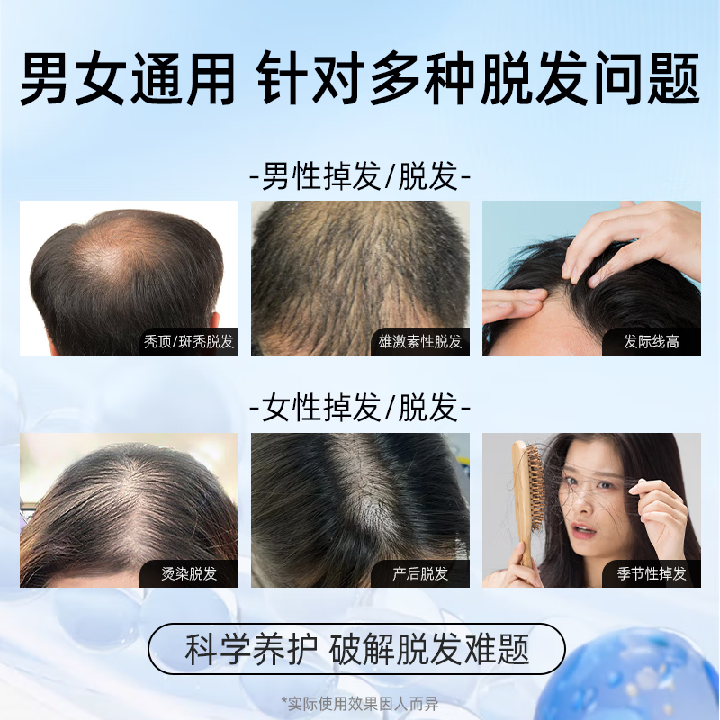 Nebe防脱固发洗发水护养头皮控油去屑蓬松柔顺洗发露男女官方正品洗发水*2 55元 - 线报酷 Nebe防脱固发洗发水护养头皮控油去屑蓬松柔顺洗发露男女官方正品洗发水*2 55元 - 线报酷