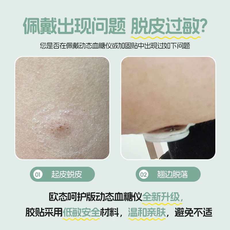 欧态呵护版动态血糖仪2盒 194.91元 - 86线报