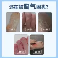 洛芙 盐酸特比萘芬喷雾剂脚气喷雾止痒脱皮杀菌盐酸特比萘芬乳膏 11.58元 图片 1