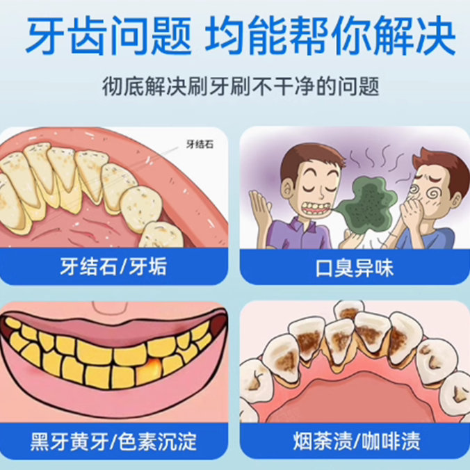 Mericle超声波洁牙器牙结石去除器冲牙清洁牙齿结石污垢洗牙仪家用神器 59元 - 86线报