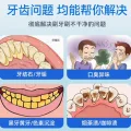 Mericle 超声波洁牙器牙结石去除器冲牙清洁牙齿结石污垢洗牙仪家用神器 券后59元 图片 2