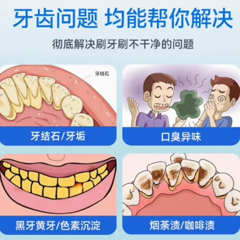 Mericle 超声波洁牙器牙结石去除器冲牙清洁牙齿结石污垢洗牙仪家用神器 券后59元 图片 2