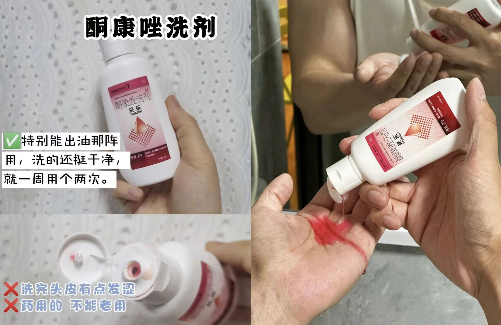 采乐酮康唑洗剂50ml*2瓶 拍下默认赠一 5.6元 - 86线报 采乐酮康唑洗剂50ml*2瓶 拍下默认赠一 5.6元 - 86线报
